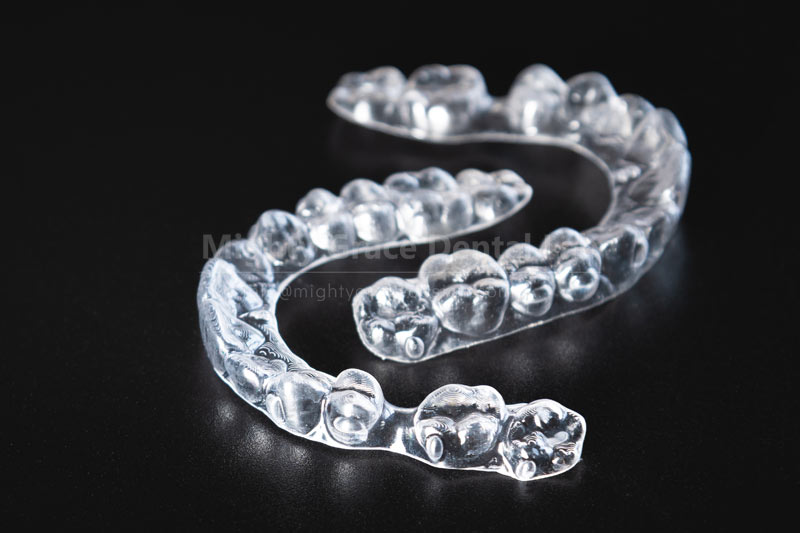 Clear Aligners: Discreetly Enhancing Your Smile Without Disrupting Your Life