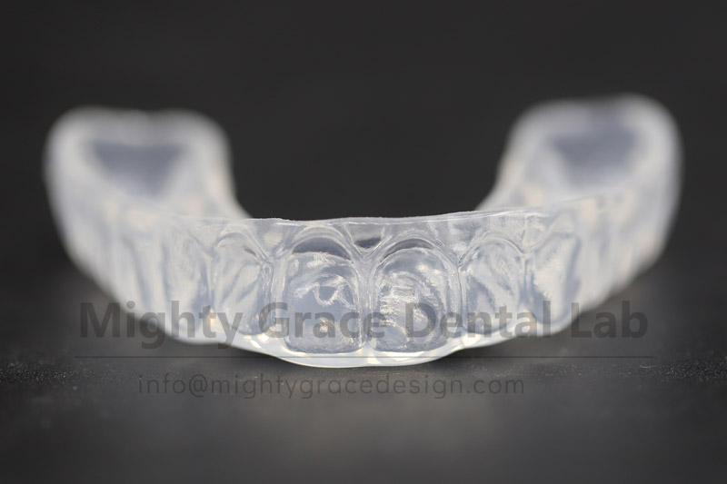 Night Guard: The Guardian of Nocturnal Dental Health