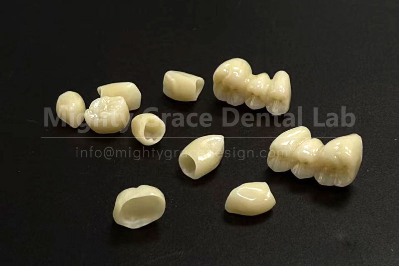All-Ceramic Crowns: Let Your Smile Look Natural and Lasting