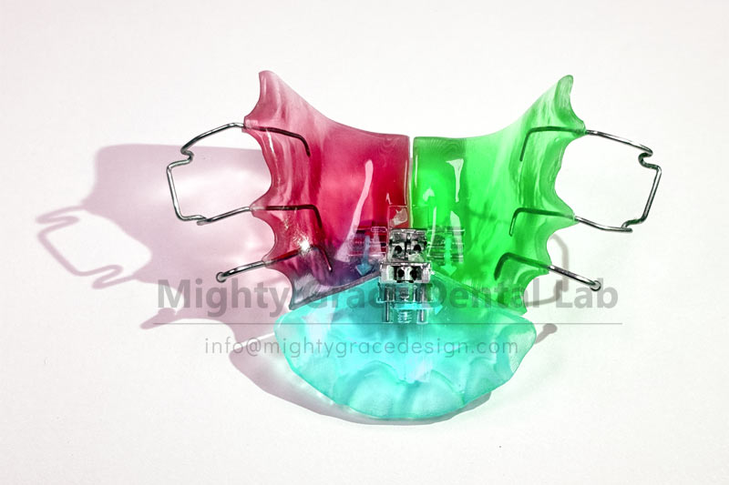 Three-dimensional Expander: Efficient Correction of Dental Arch Narrowing and Crossbite