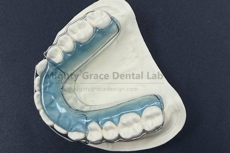 Choosing the Begg Retainer: Adding Active Insurance to Your Orthodontic Results