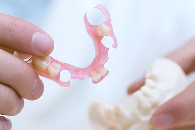 Say Goodbye to Metal Clasps: How ＂Invisible＂ Flexible Partials Make Eating More Comfortable