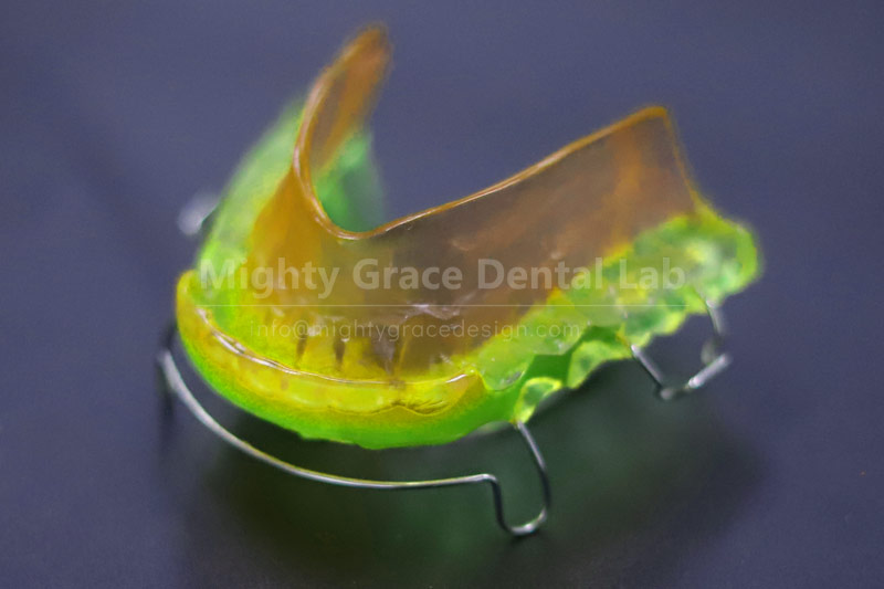 Don't Worry About Your Child's Crooked Teeth: Early Intervention with an Activator Delivers Great Res