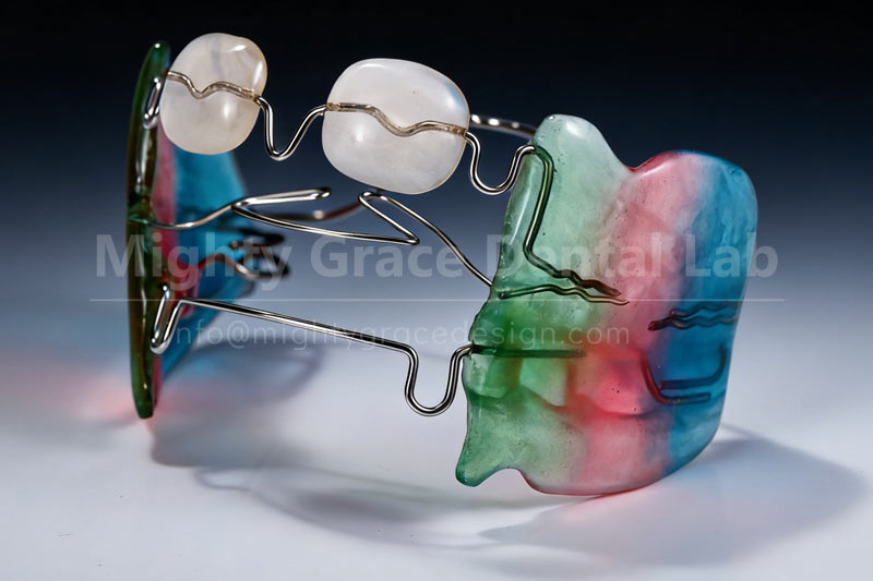 Frankel-3 Appliance: Guiding Children's Facial Development at the Root