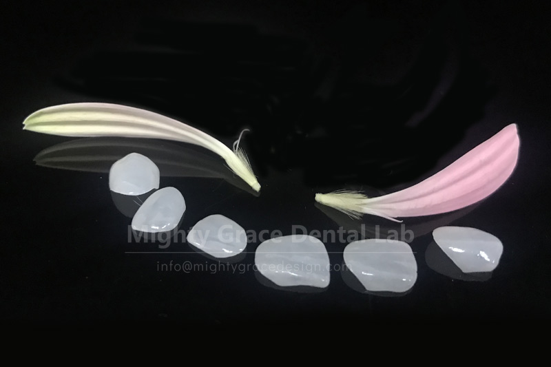 Porcelain Veneers: Minimally Invasive Aesthetic Enhancement, Nearly Imperceptible