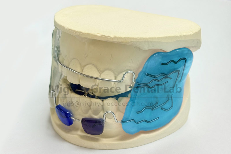 Does your child have a protruding mouth and a receding chin? Try the Frankel 2 appliance to bring the chin forward