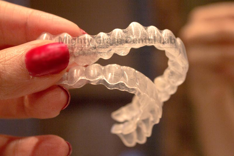A Subtle Transformation Begins with a Pair of Clear Aligners