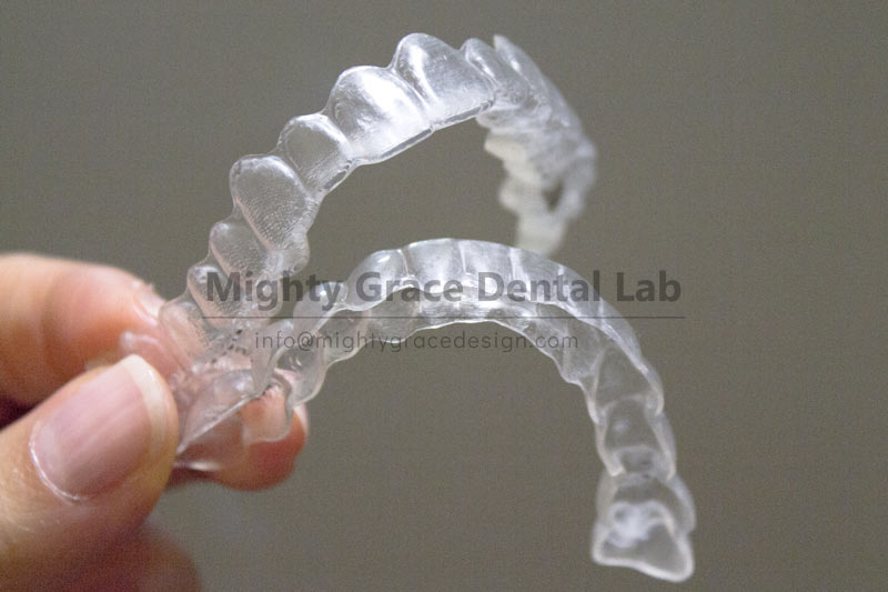 Outsourced Clear Retainer Processing: A Choice That Balances Quality and Efficiency