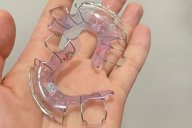 Don’t let your guard down after orthodontic treatment – Hawley retainers help keep your teeth straight.