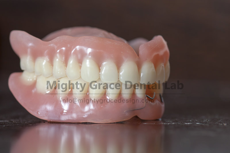 Choose Acrylic Denture: Economical and Practical