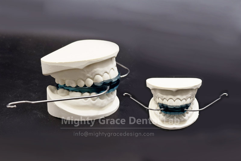 Buck teeth and chin retrusion in your child? The Van Beek activator makes early correction more efficient.