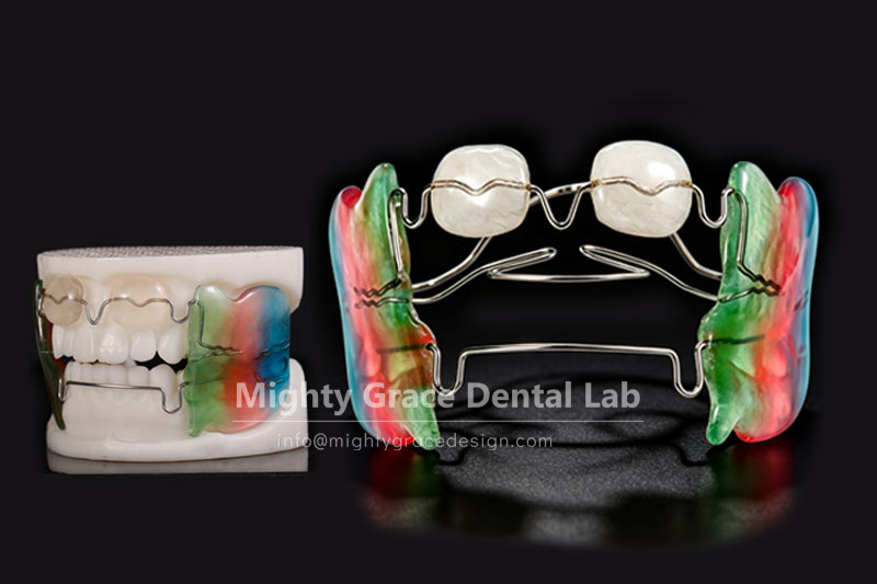 Don't wait until permanent teeth come in—let the Frankel III appliance help your child seize the go