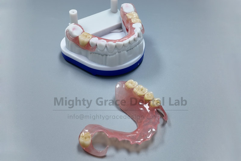 Take off those metal clasps – a flexible partial is the answer to comfortable eating.