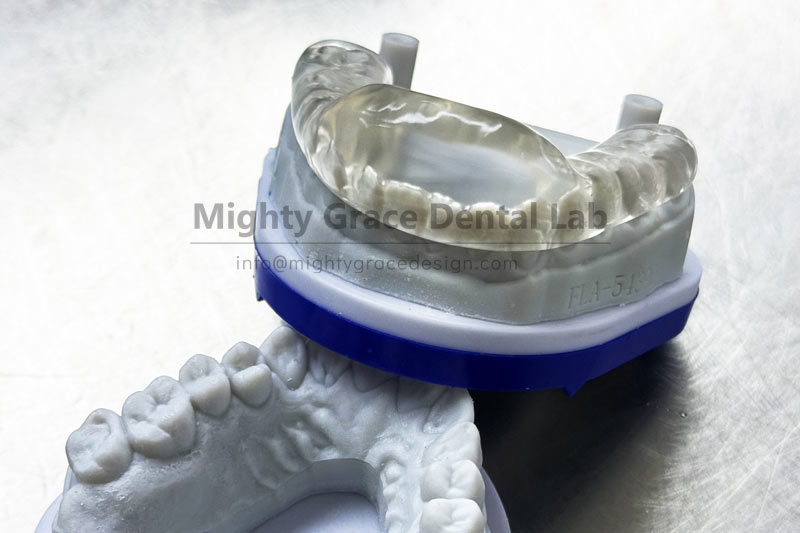 Night guards come in soft, hard, and soft-inside-hard-outside – which one should you choose based on the severity of your bruxism?