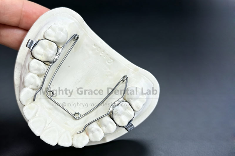 Four-Eye Spring Expander: A Practical Method for Creating Space for Tooth Alignment