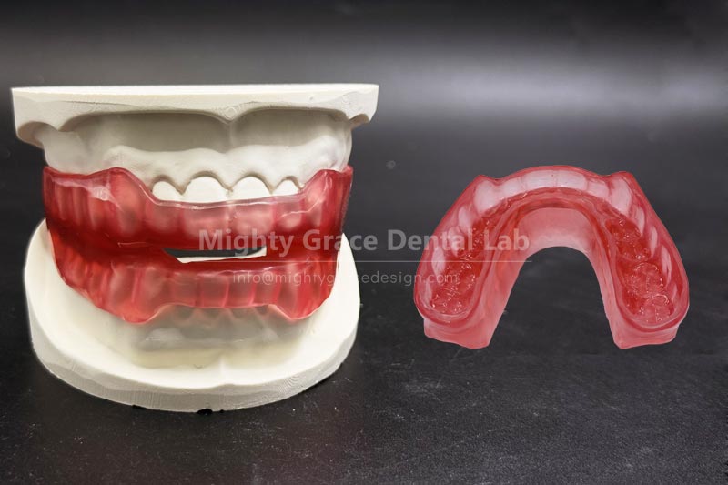 Say goodbye to nighttime snoring – start with a custom-fitted anti-snoring device