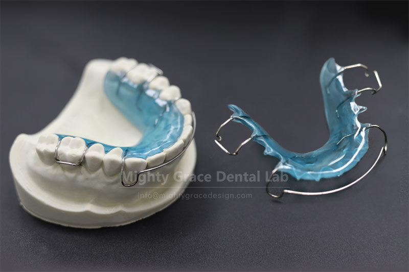 Hawley Retainer – A Reliable Tool in the Eyes of Clinicians, Making Orthodontic Finishing Easier