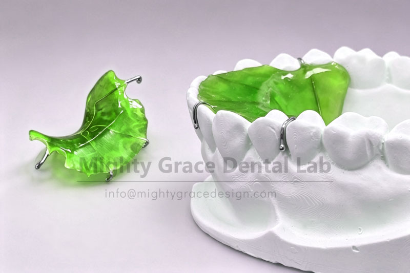 Brackets keep falling off during braces? Maxillary bite plate helps hold things steady.