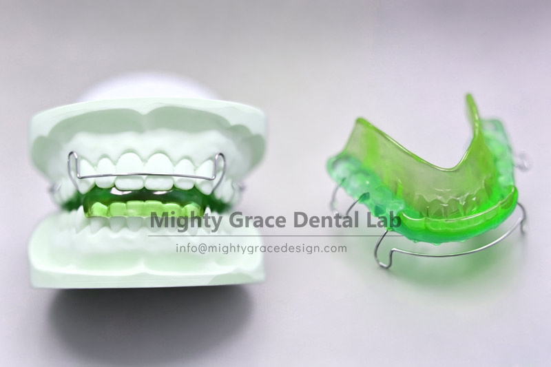 Don’t wait until teeth are already crooked to start orthodontics – the Activator corrects problems early during the mixed dentition period.