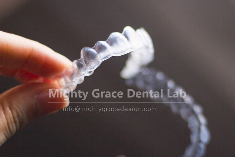 Orthodontic treatment without compromise – clear aligners make life easier