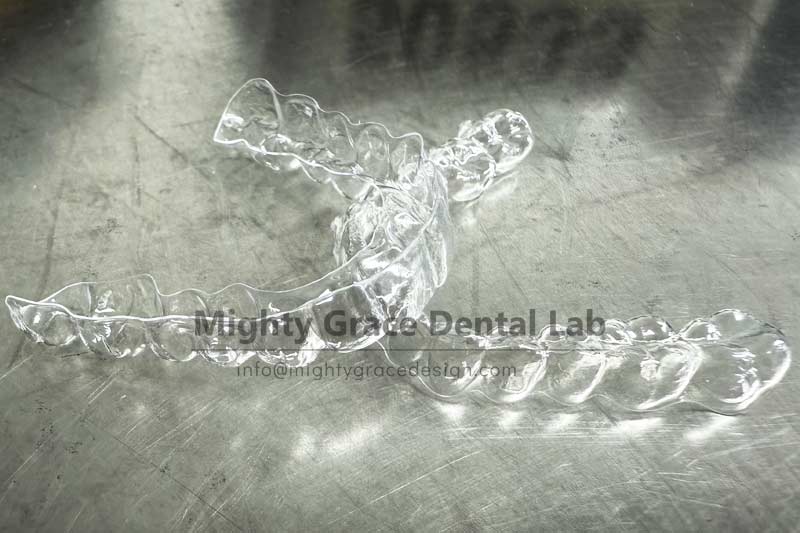 Braces Off Is Not the End – Clear Retainers Are the Long-Term Guardian