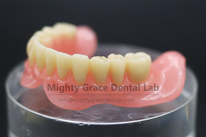 Complete Suction-Retained Dentures: Helping Elderly People with Missing Teeth Say Goodbye to Slipping Dentures
