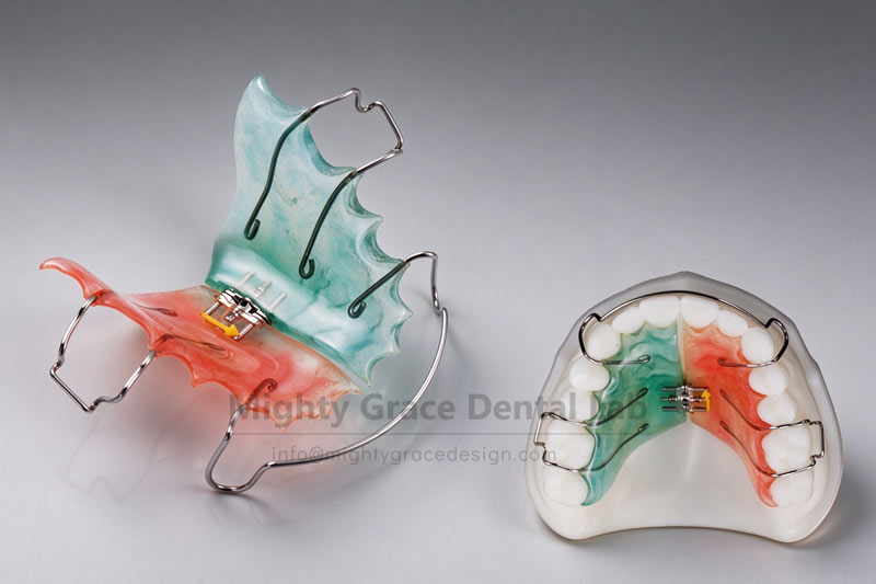 An Effective Tool for Correcting Narrow Dental Arches: Understanding the Standard Spiral Expander