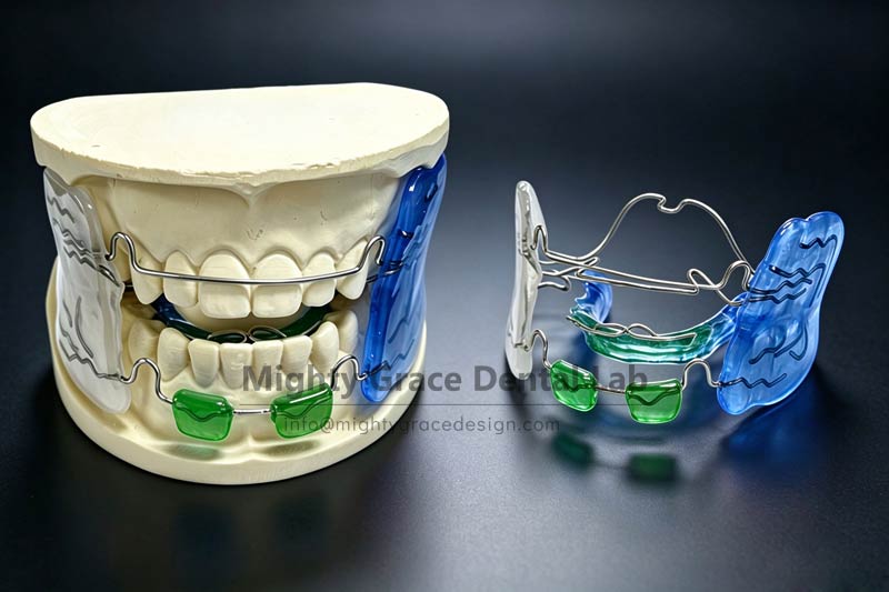 Can They Quietly Become Better-Looking Without Tooth Extraction? The Frankel 2 Functional Appliance Helps Children Correct Habits
